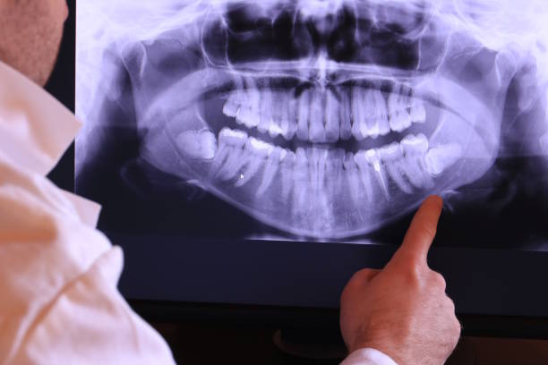 Best Emergency Treatment for Toothache in River Bend, NC
