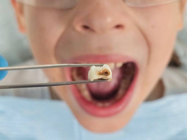 Best Emergency Broken Tooth Repair in River Bend, NC
